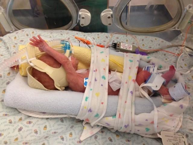 Caden as an infant in the NICU